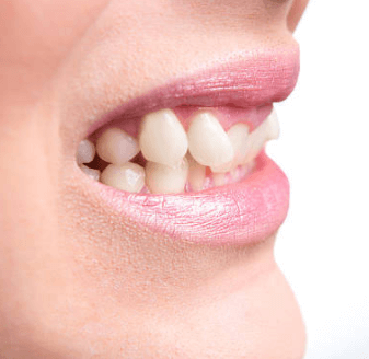 Carole Vargas ORTHODONTISTE